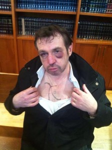 Male victim of an anti-semitic attack